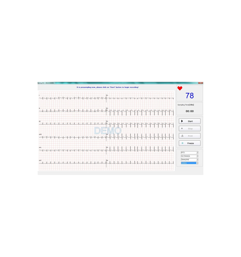 ECG PC SE-1010 Edan