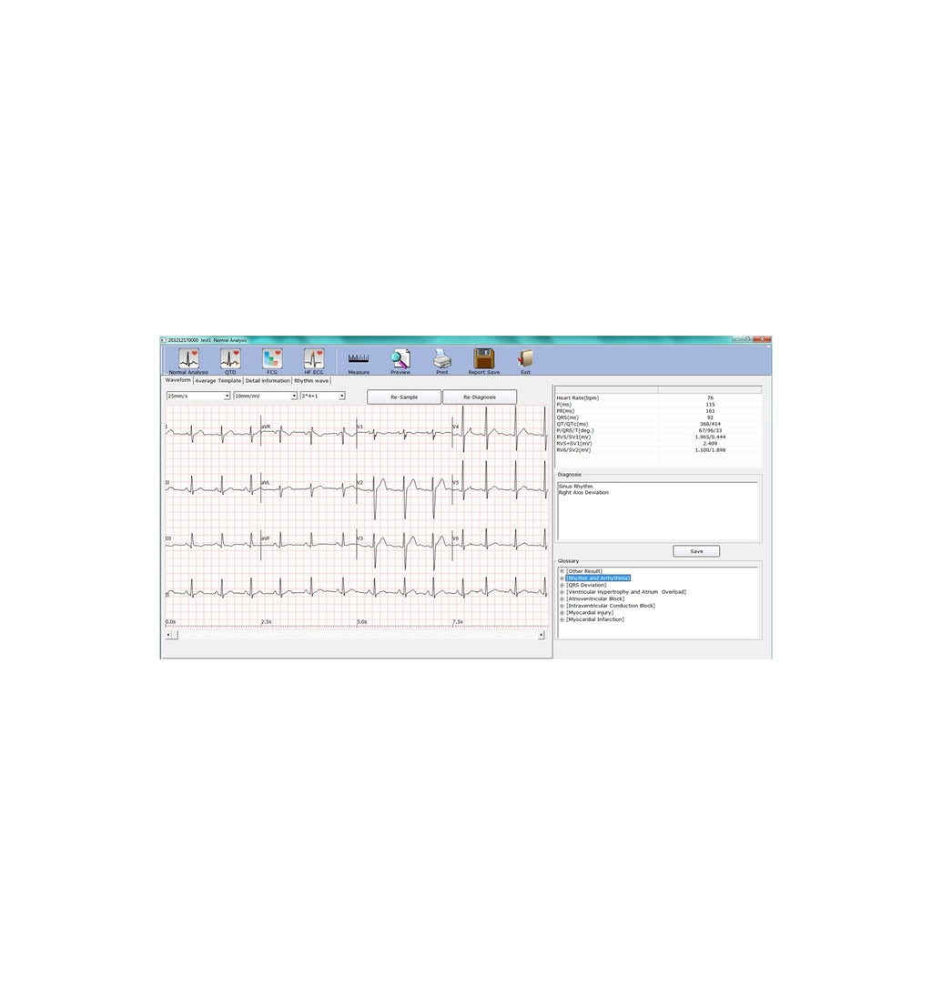 ECG PC SE-1010 Edan