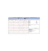 ECG PC SE-1010 Edan