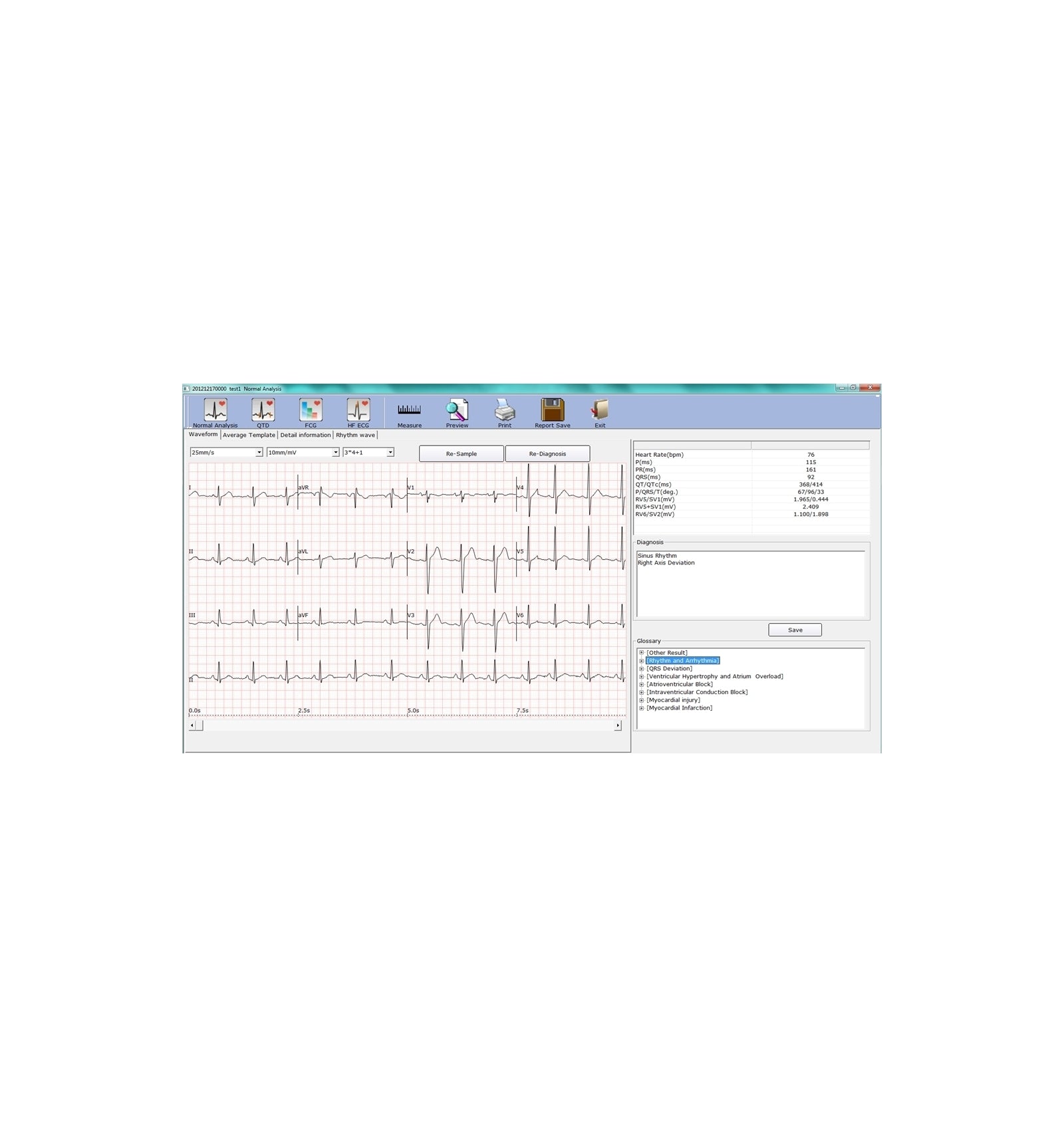 ECG PC SE-1010 Edan