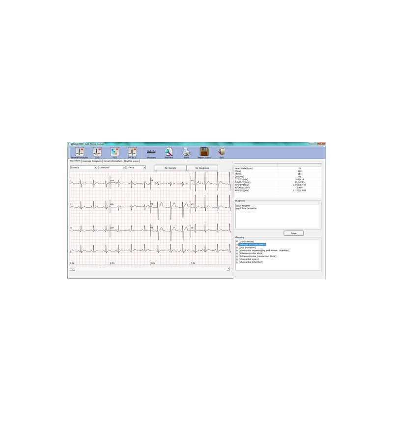 ECG PC SE-1010 Edan