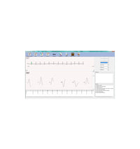 ECG PC SE-1010 Edan