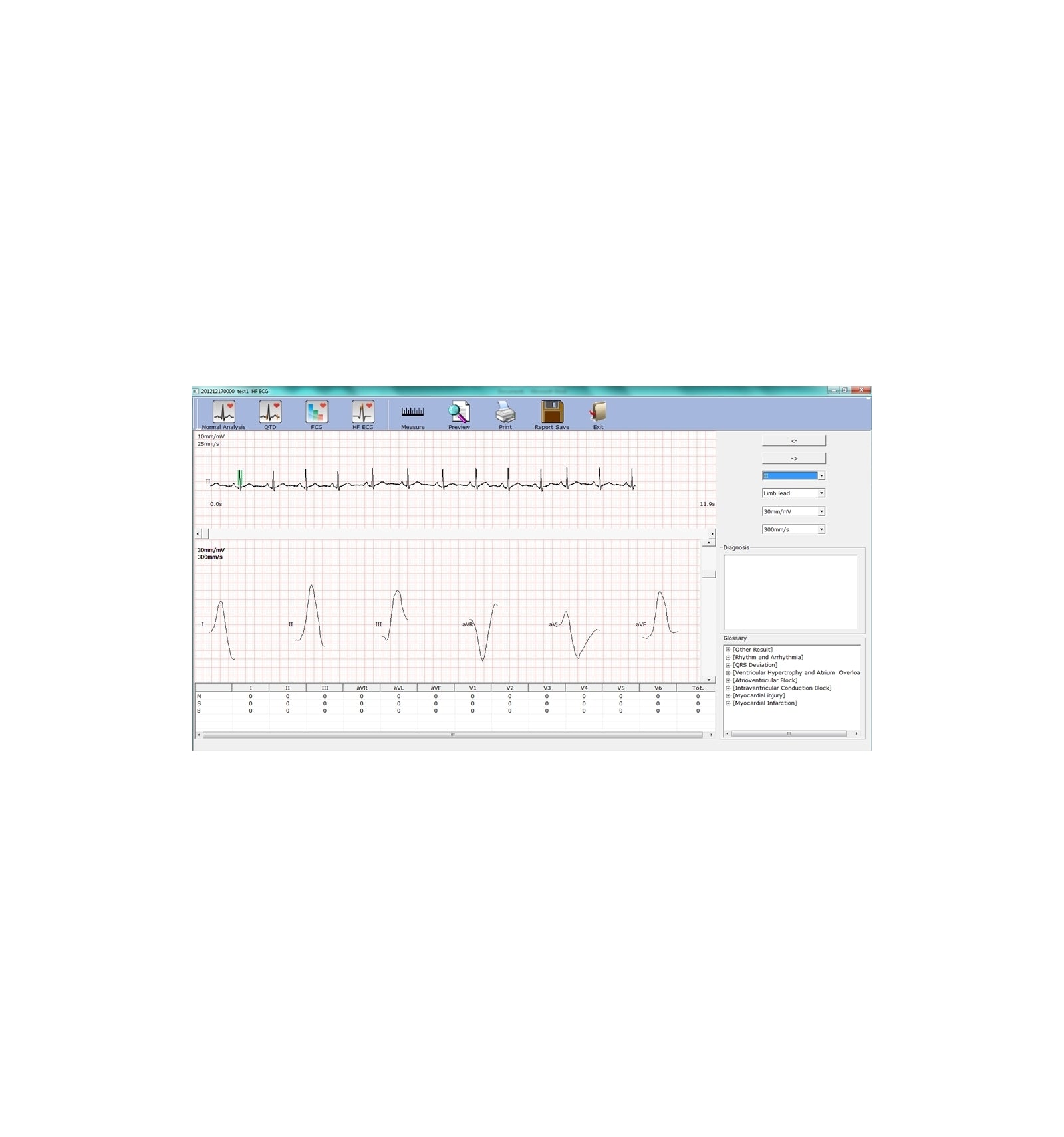 ECG PC SE-1010 Edan