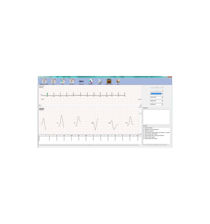 ECG PC SE-1010 Edan