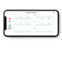 ECG connecté KardiaMobile 1 et 6 dérivations - Omron
