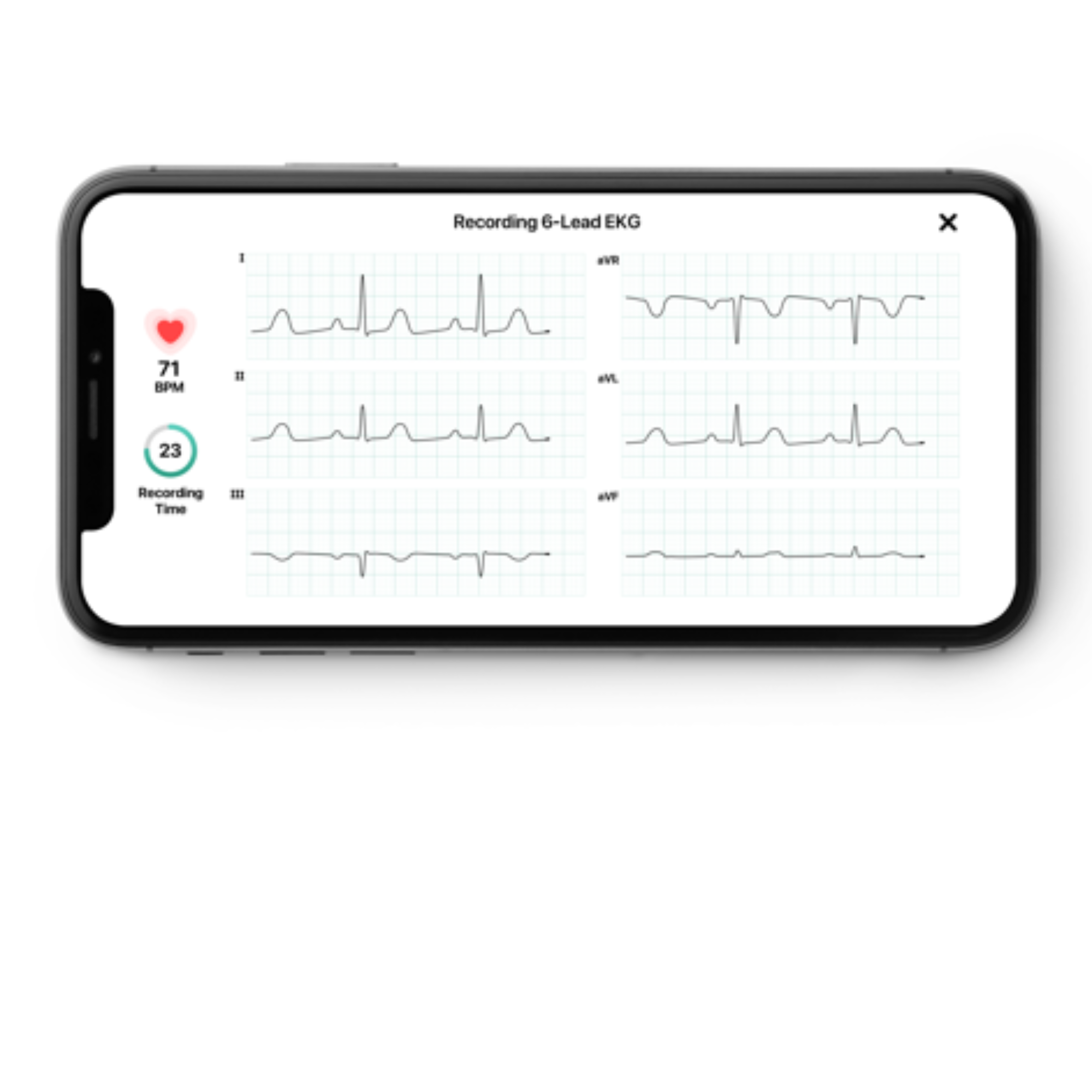 ECG connecté KardiaMobile 1 et 6 dérivations - Omron