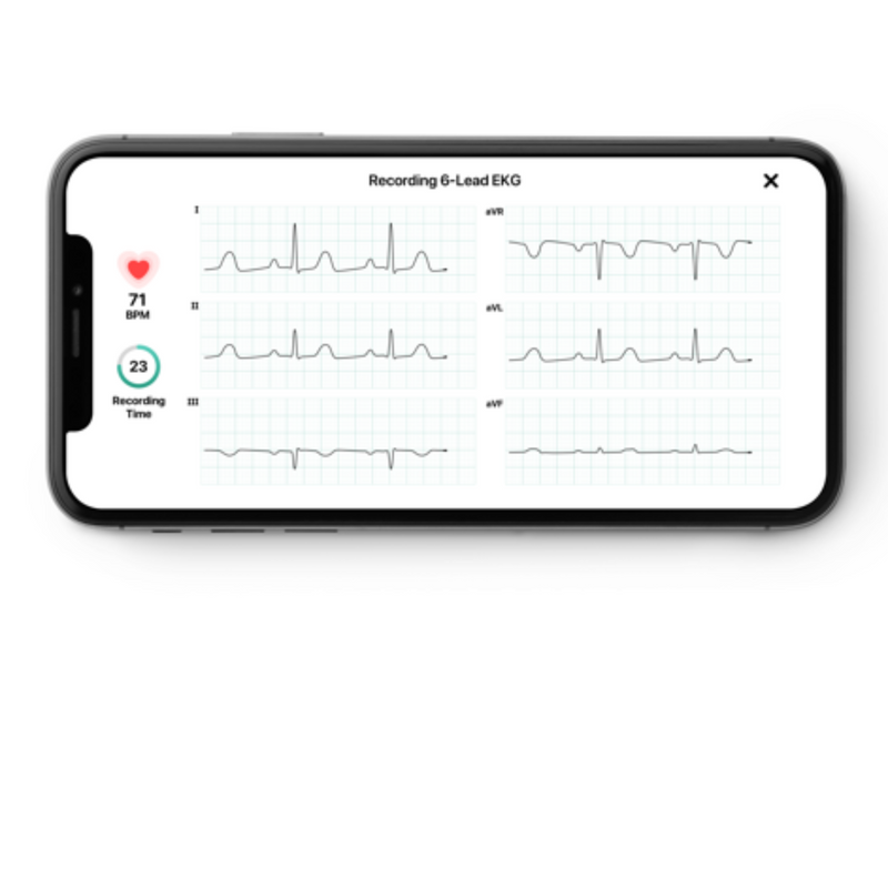 ECG connecté KardiaMobile 1 et 6 dérivations - Omron