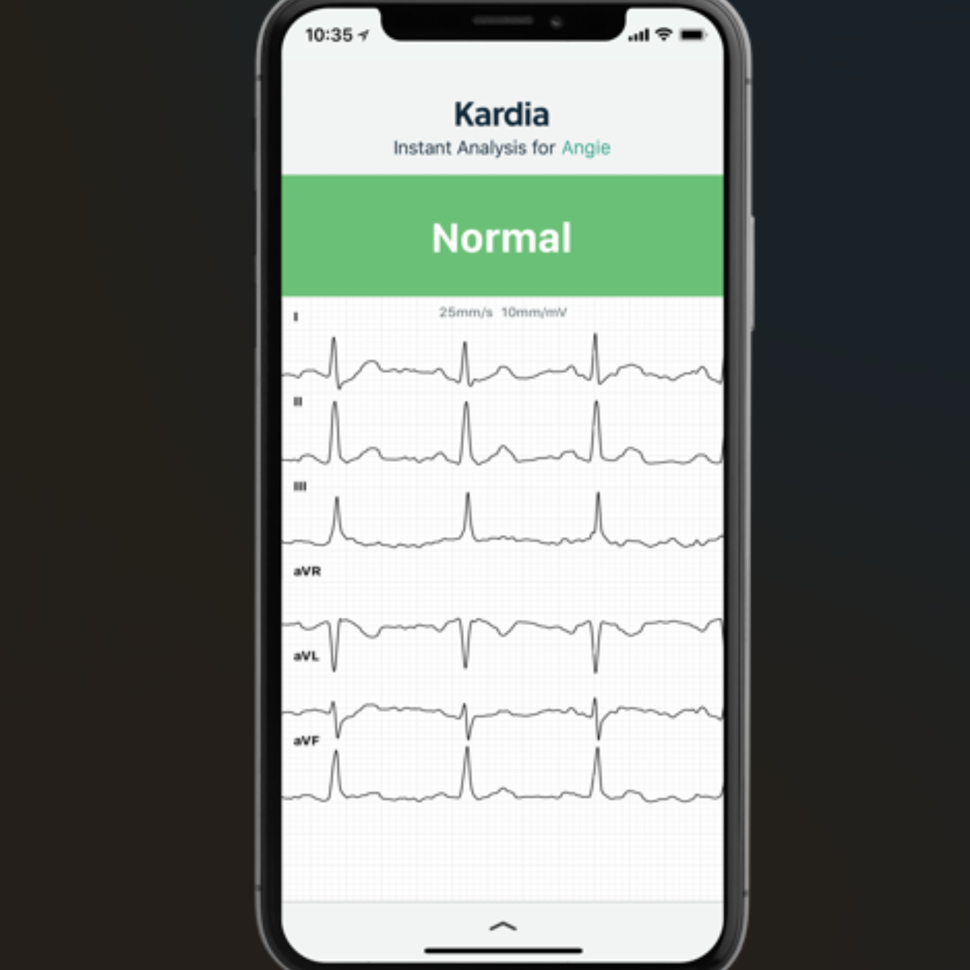 ECG connecté KardiaMobile 1 et 6 dérivations - Omron