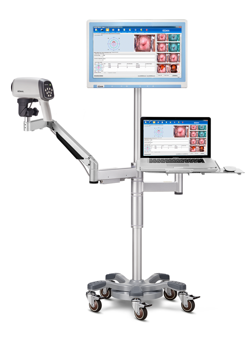 Vidéo-colposcope C6A- EDAN