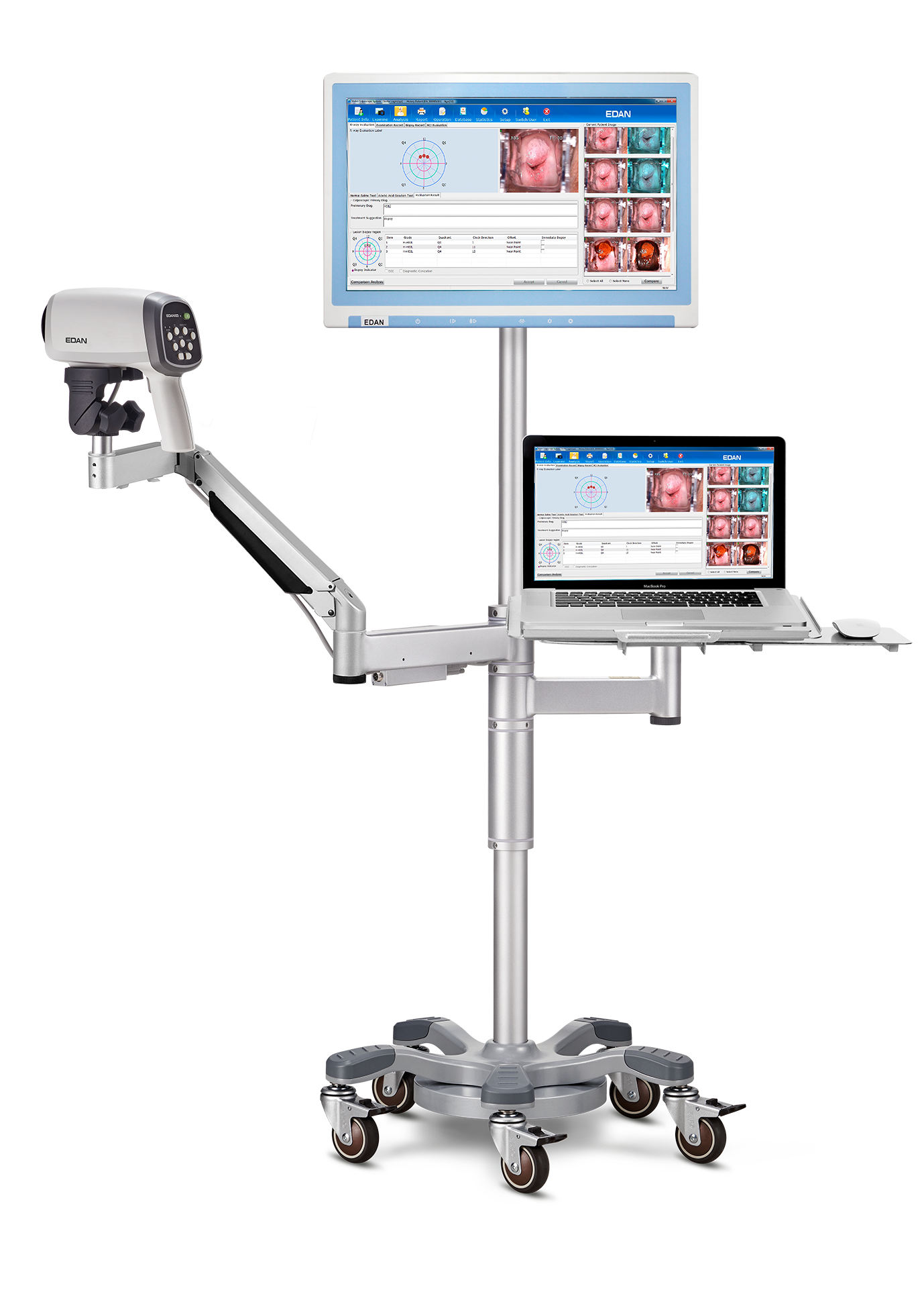 Vidéo-colposcope C6A- EDAN