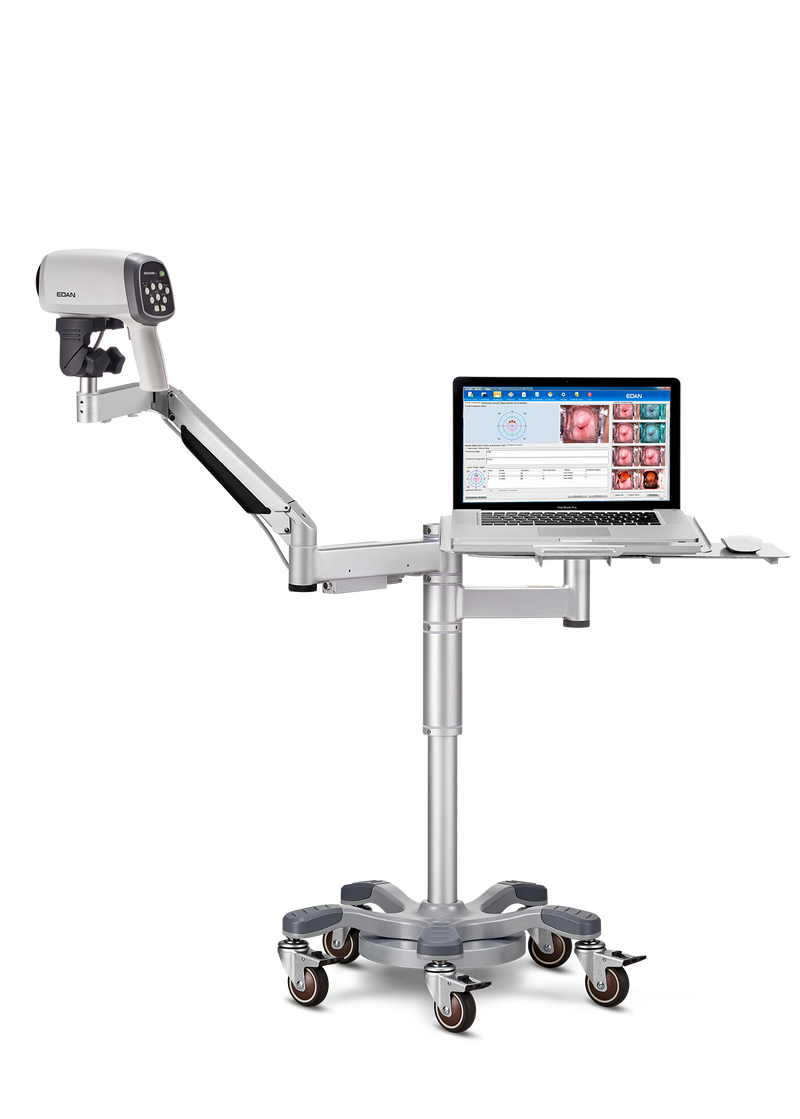 Vidéo-colposcope C6A- EDAN