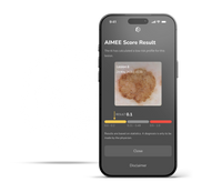 Dermatoscope DermLite DL5 Plus