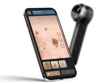 Dermatoscope DermLite DL5 Plus