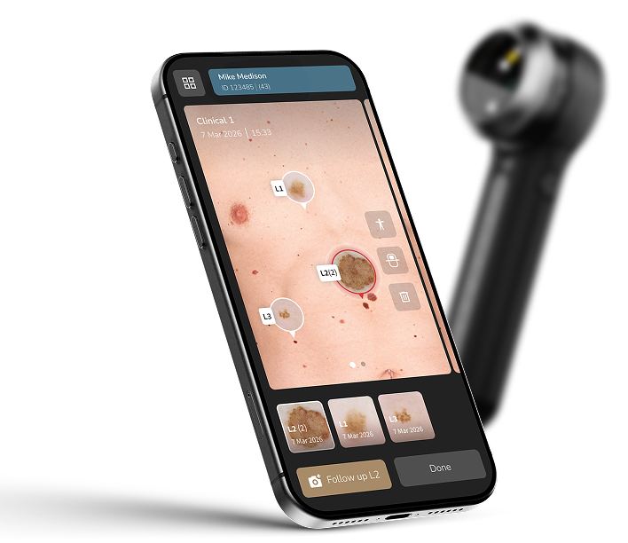 Dermatoscope DermLite DL5 Plus