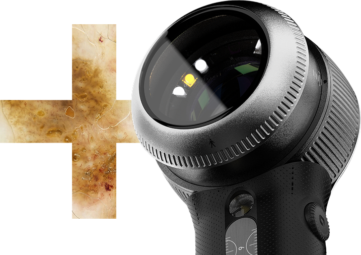 Dermatoscope DermLite DL5 Plus