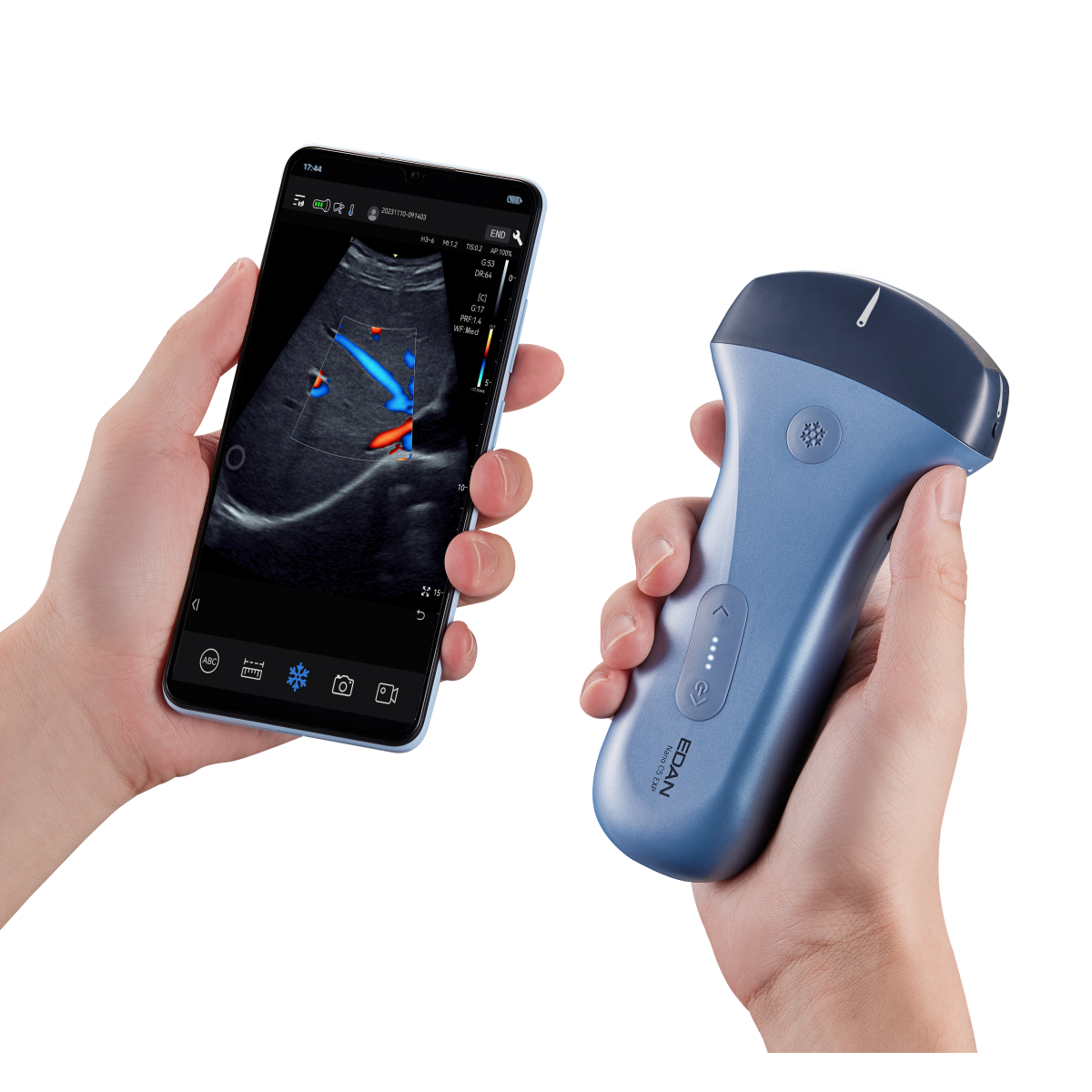 Echographe couleur portable Edan Nano convexe
