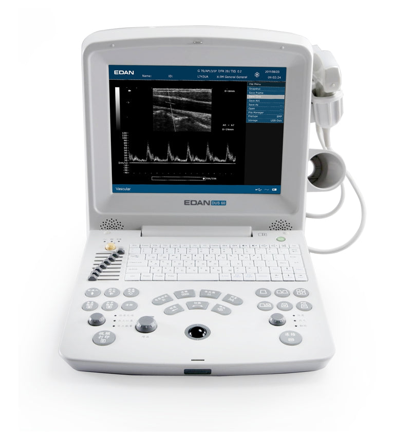 Echographe portable DUS60 EDAN - Unité centrale