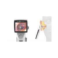 Otoscope digital avec écran, SyncVision iO1 Elite