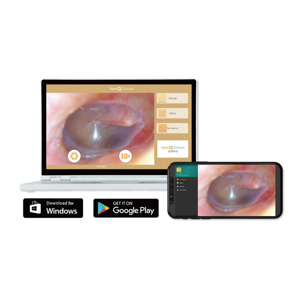 Otoscope digital avec écran, SyncVision iO1 Elite