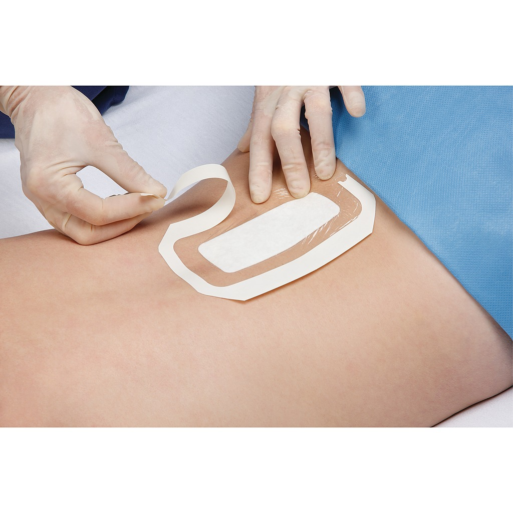 Pansement adhésif stérile transparent avec compresse 3M™ Tegaderm + Pad