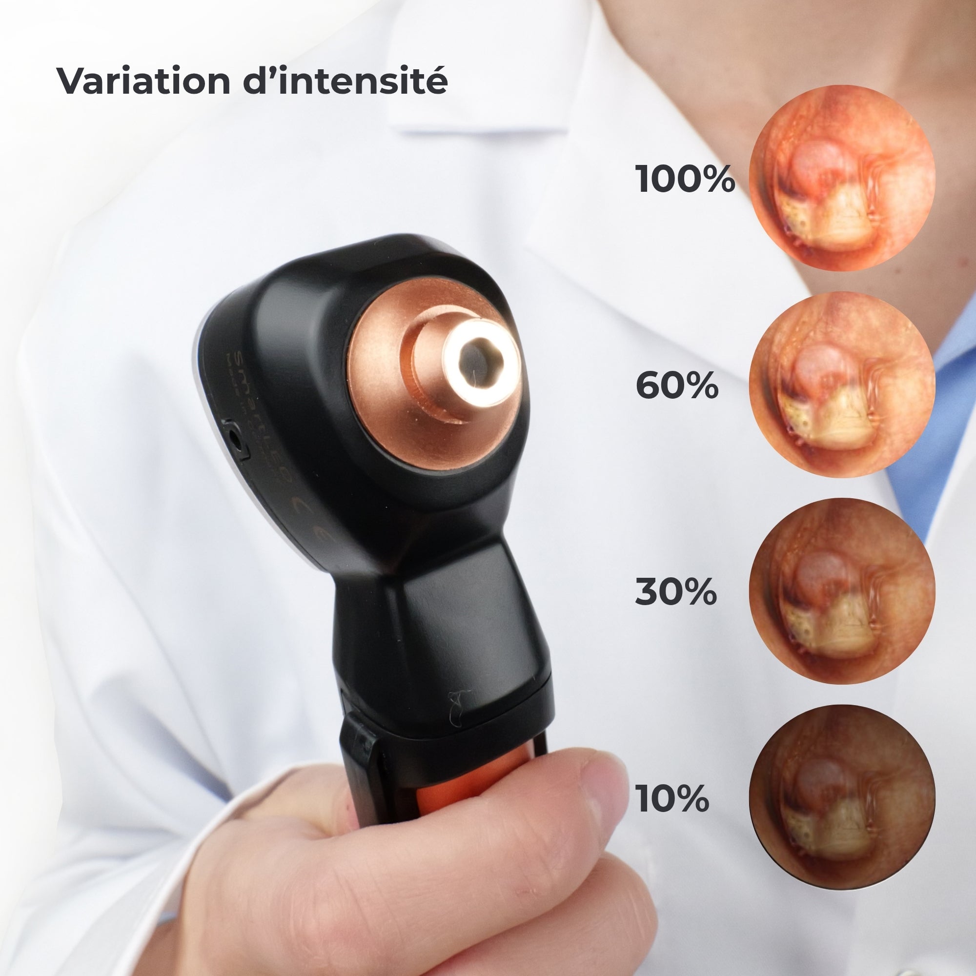 Otoscope Spengler SmartLed