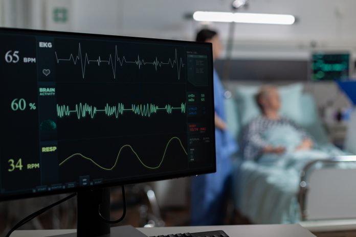 Tout savoir sur les ECG : Le guide complet