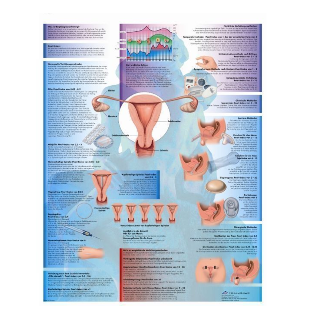 Planche anatomique Contraception - 3B Scientific