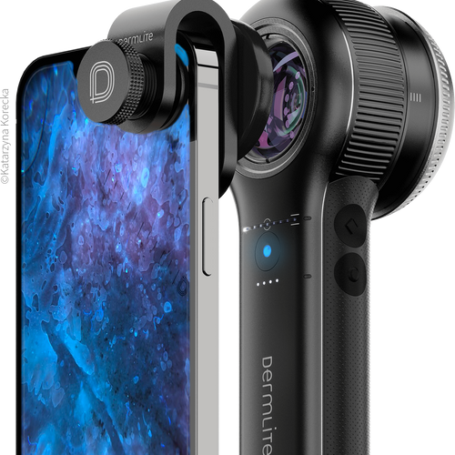 Dermatoscope DermLite DL5 Plus