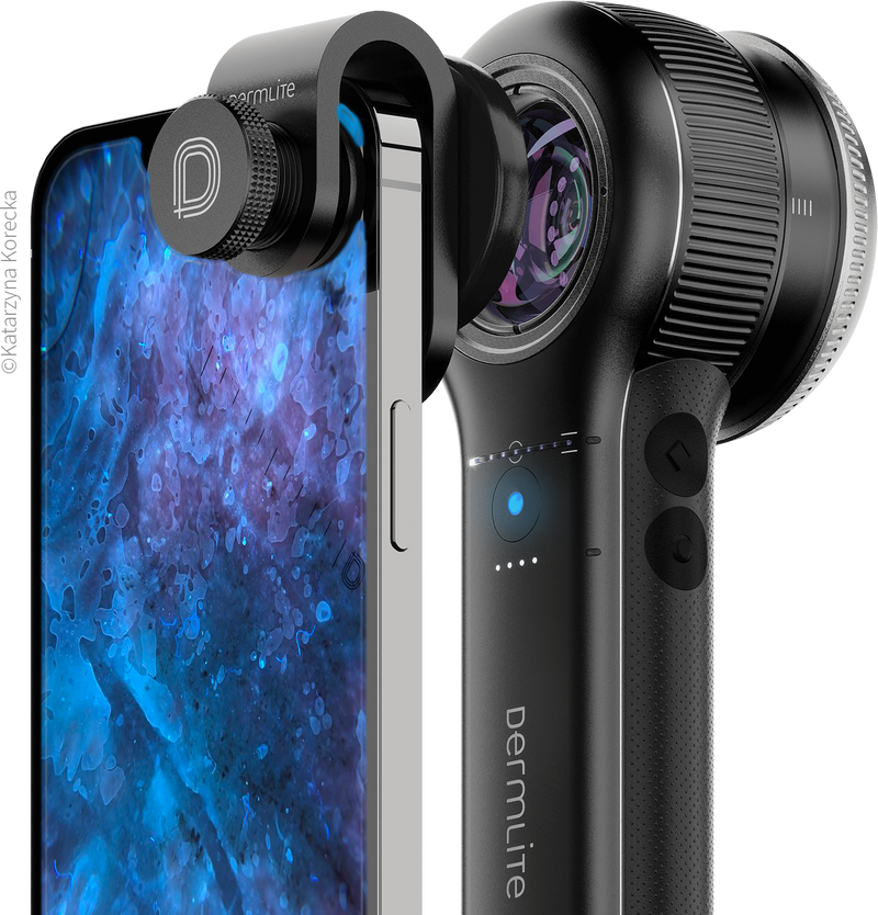 Dermatoscope DermLite DL5 Plus