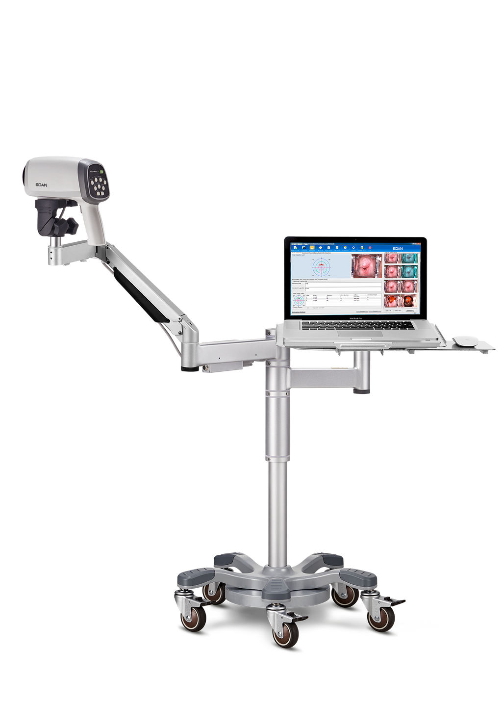 Vidéo-colposcope C6A- EDAN