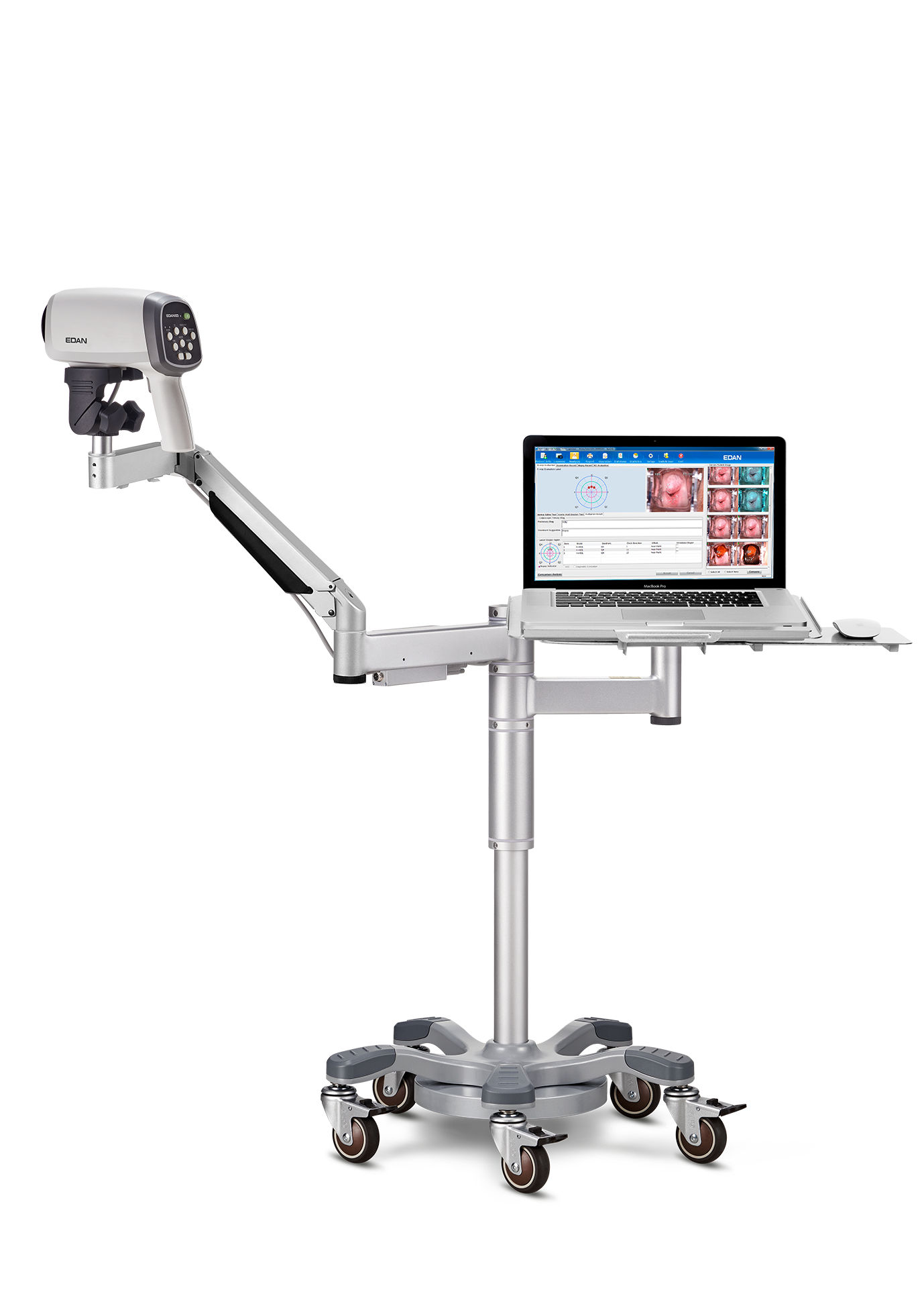 Vidéo-colposcope C6A- EDAN