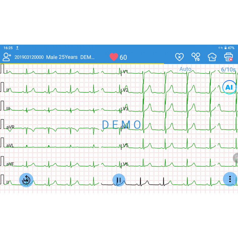 ECG EDAN SE-1200 Pro 12 pistes, tactile avec imprimante