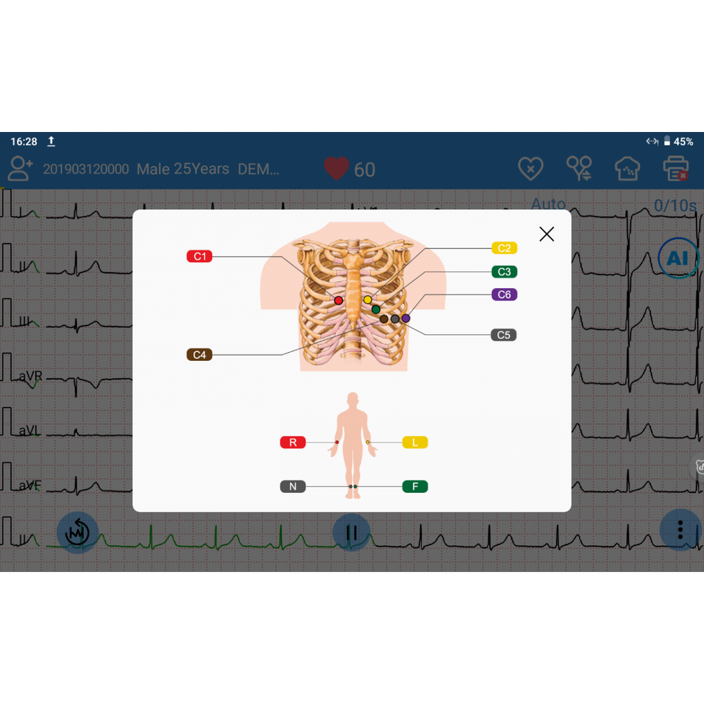 ECG EDAN SE-1200 Pro 12 pistes, tactile avec imprimante