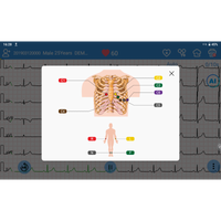 ECG EDAN SE-1200 Pro 12 pistes, tactile avec imprimante