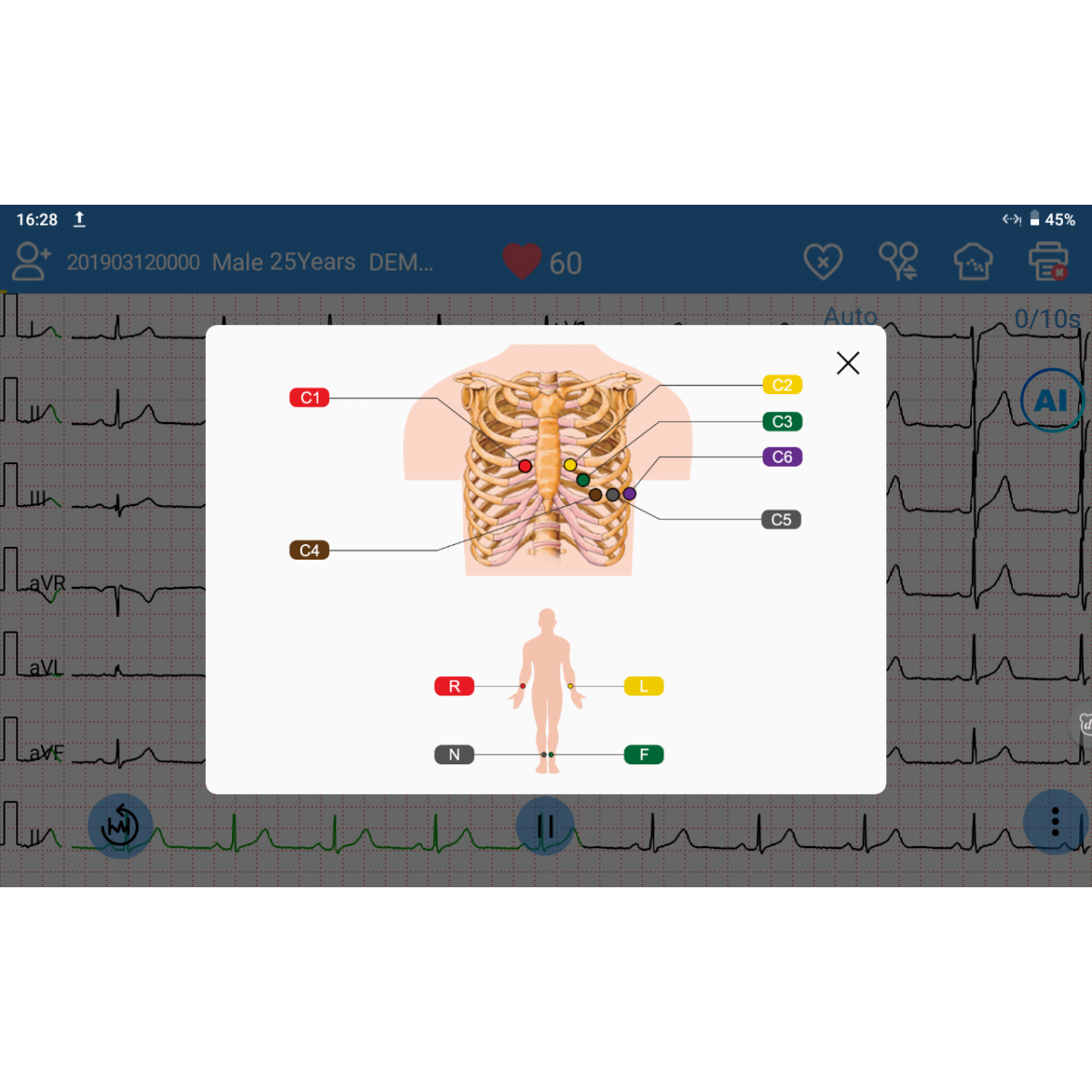ECG EDAN SE-1200 Pro 12 pistes, tactile avec imprimante