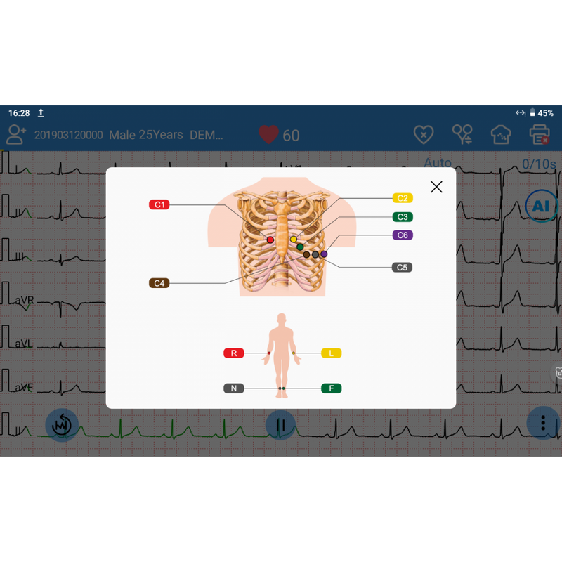 ECG EDAN SE-1200 Pro 12 pistes, tactile avec imprimante