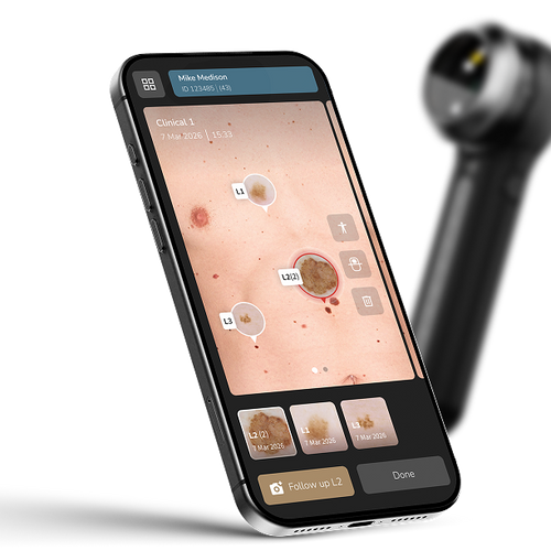 Dermatoscope DermLite DL5 Plus