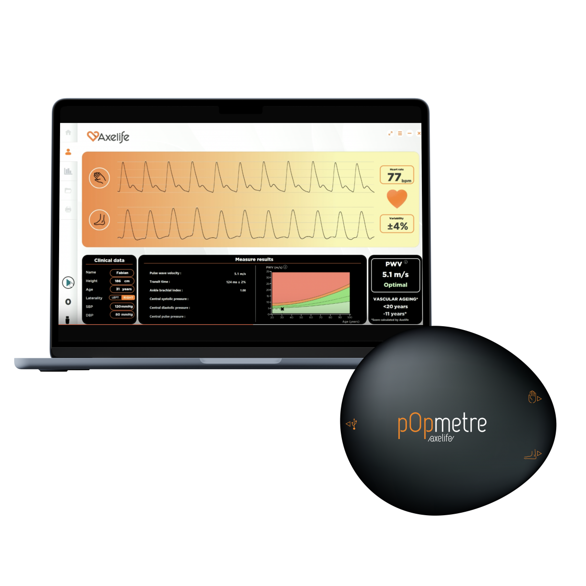 Appareil de mesure du risque cardiovasculaire pOpmètre®
