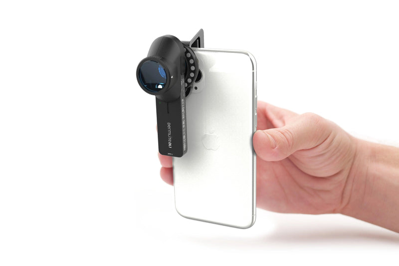 Dermatoscope Dermlite DL1