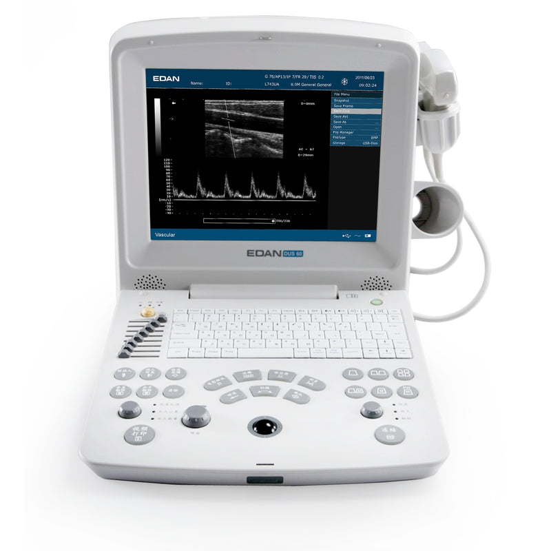 Echographe portable DUS60 EDAN - Unité centrale