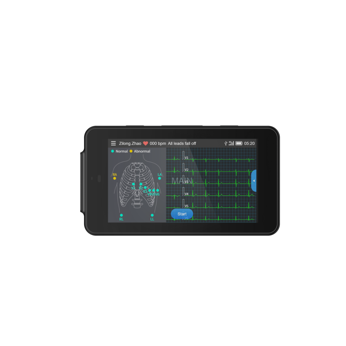 Tablette ECG de poche Cardio One Mini