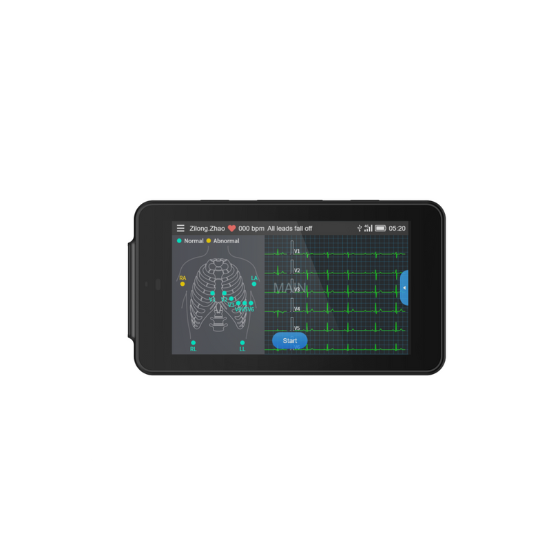 Tablette ECG de poche Cardio One Mini