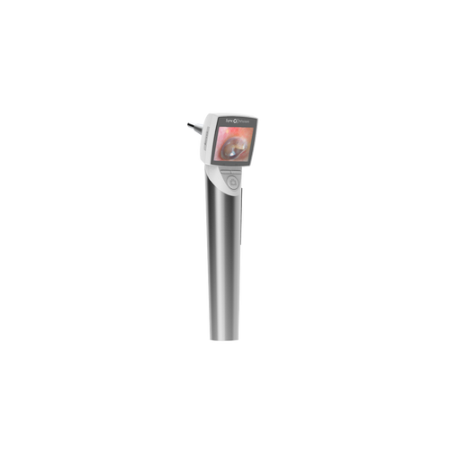 Otoscope digital avec écran, SyncVision iO1 Elite