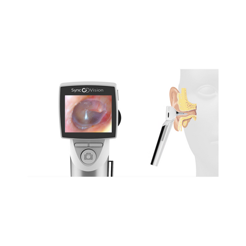 Otoscope digital avec écran, SyncVision iO1 Elite