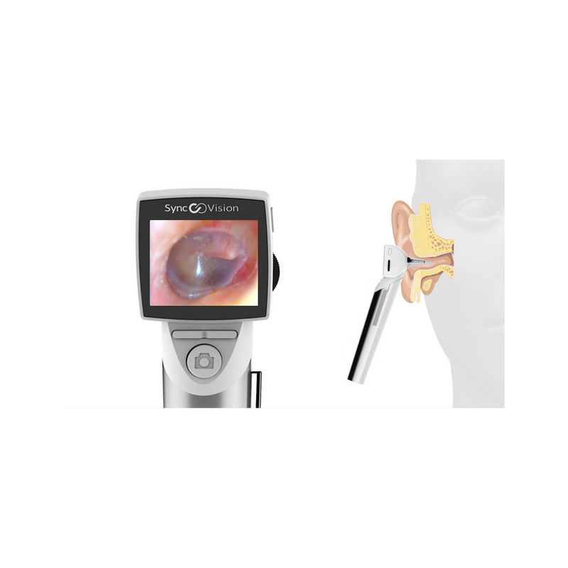 Otoscope digital avec écran, SyncVision iO1 Elite